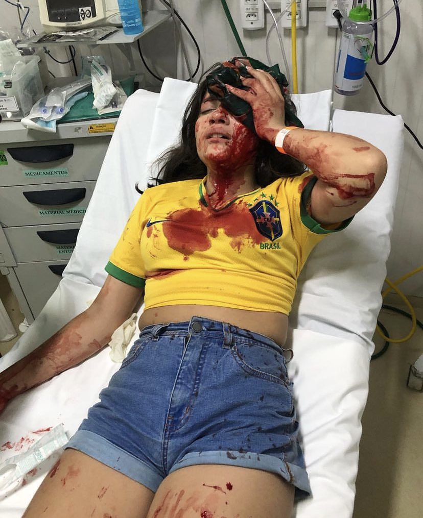 thaispsic's tweet photo. Será que a Globo vai mostrar o que os petistas fizeram com uma menina de 13 anos???
É uma luta do bem contra o mal, e vamos vencer! 🙏🏻🇧🇷
Melhoras, Ivy. ❤️‍🩹😢 https://t.co/E8I2XhMgG5