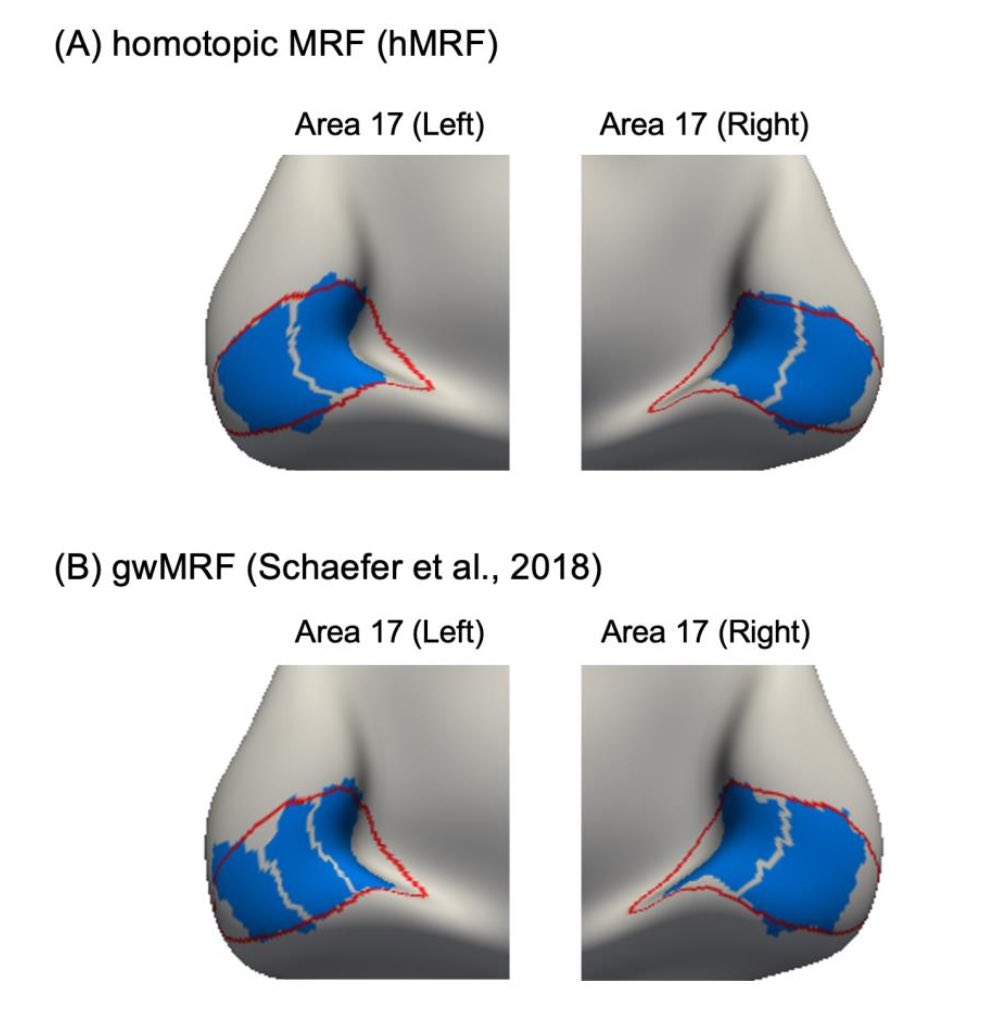 mathilde0427's tweet photo. (1/5)  🥳My homotopic parcellation paper is ready as a preprint! 
￼
🧠The lack of homotopy between left and right of the Schaefer parcels has limited its usage for brain lateralization studies. 
￼
💡Here, we extend our previous model to account for homotopy https://t.co/foE7yGtpy0