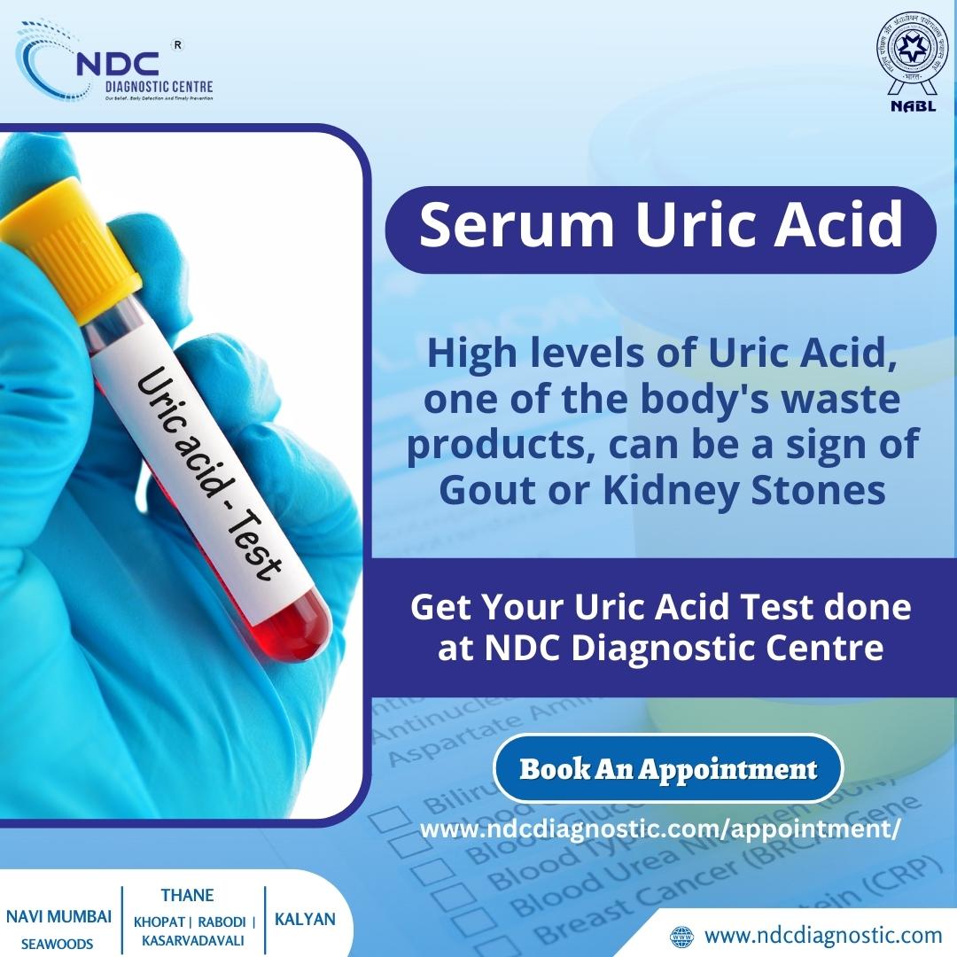DiagnosticNdc's tweet photo. Don't put your health to the test!

Get Your Serum Uric Acid Test Done at NDC Diagnostic Centre!💯

🔗 Visit us: https://t.co/eJ8EFukJP8
 
#ndcdiagnostic #serumuricacidtest #uricacid #bloodurea #BUN #health #kidney #healthylifestyle #bloodsugar #bloodpressure #doctor #health https://t.co/yXmYes5Ilu