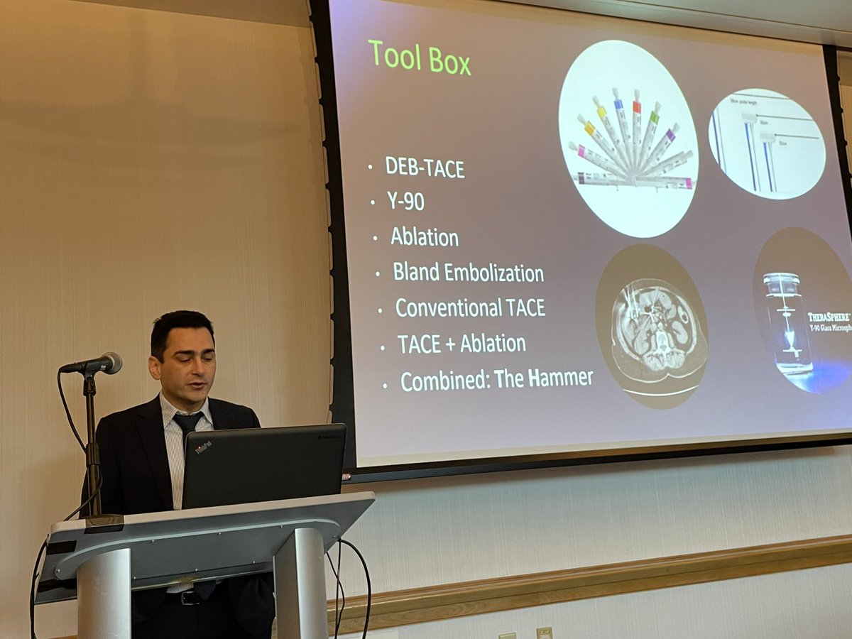 shimulshah73's tweet photo. @transplant_u @KordAMD @Tsubame4182 @kristinalemon22 @alex_chang_md @GregWilson152 @ksafdarmd @cincysurgery @uc_vir @uc_health Excellent talk about y-90 and why it should be the FIRST option for downstaging https://t.co/TphMFLQllT