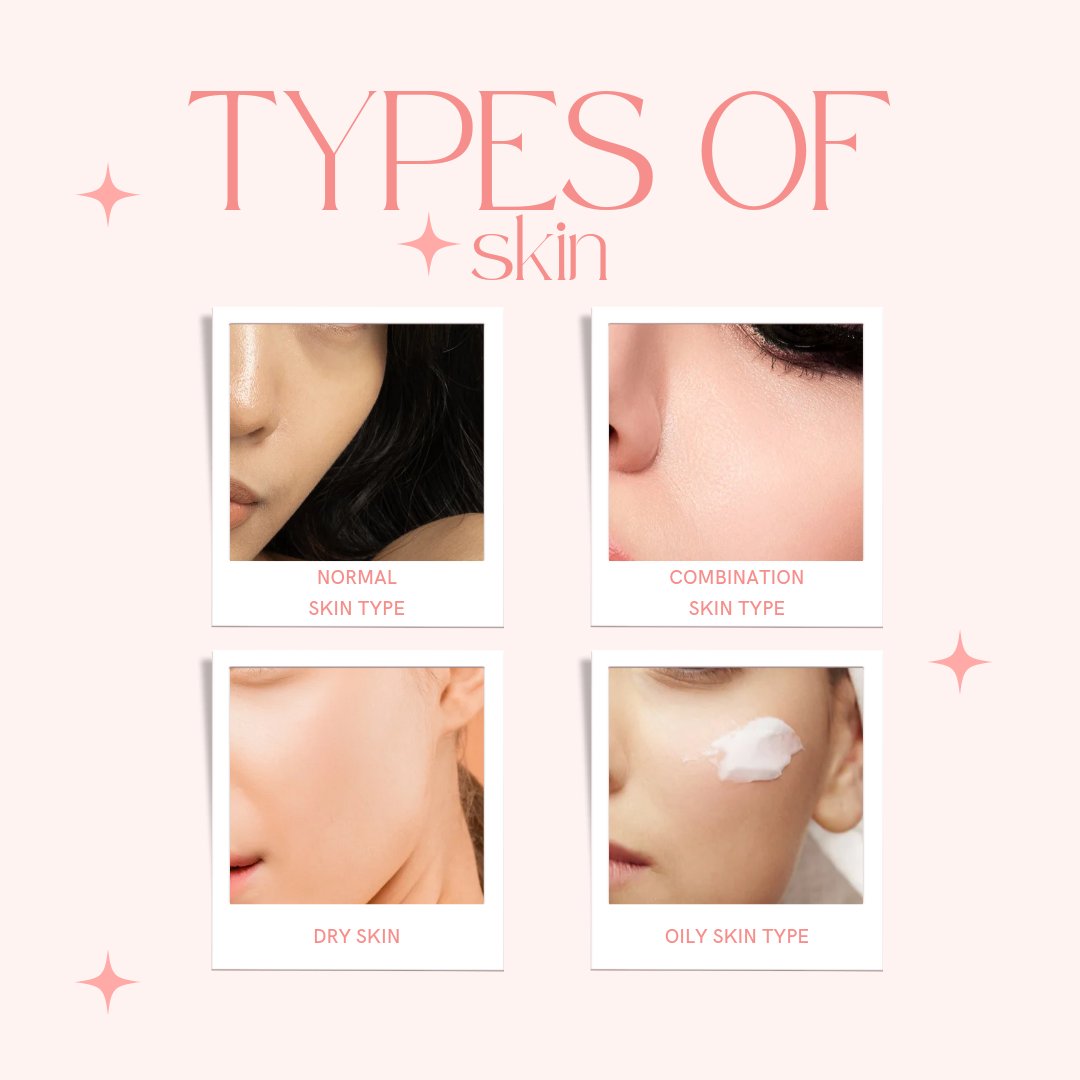 StuffNatural's tweet image. What is your type of skin?

#natural #beautiful #skincare #selfcare #beauty #handcream #healthyliving #lifestyle #essentialoil #coldpressedoil #healthymonday #skincareroutine