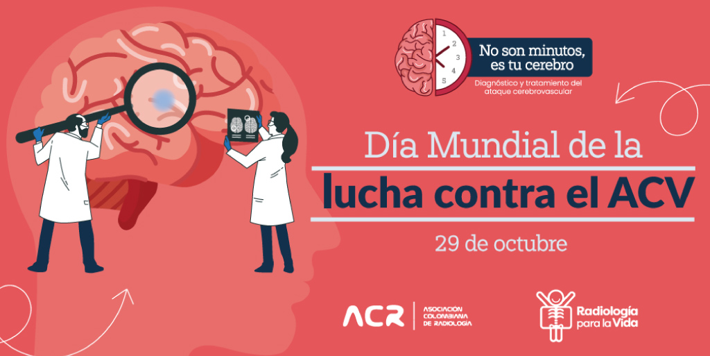 ACRadiologia's tweet photo. Cada año, casi 14 millones de personas sufren un ACV en todo el mundo; de estos 5,5 millones morirán. El ataque cerebrovascular es la segunda causa principal de muerte y la tercera causa principal de discapacidad en todo el mundo (World Stroke Organization). https://t.co/dcRisZZzEl