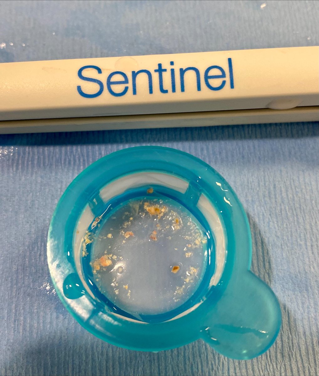 BSCCardiology's tweet photo. Stroke during TAVR happens, and every #TAVR patient deserves protection. This #WorldStrokeDay learn more about the reality of TAVR-related #stroke and SENTINEL™ Cerebral Embolic Protection: https://t.co/PwsV8IvYae 

#PROTECTEDTAVR
Safety info: https://t.co/B9ehbjyUBm https://t.co/iV9KLUN1q7