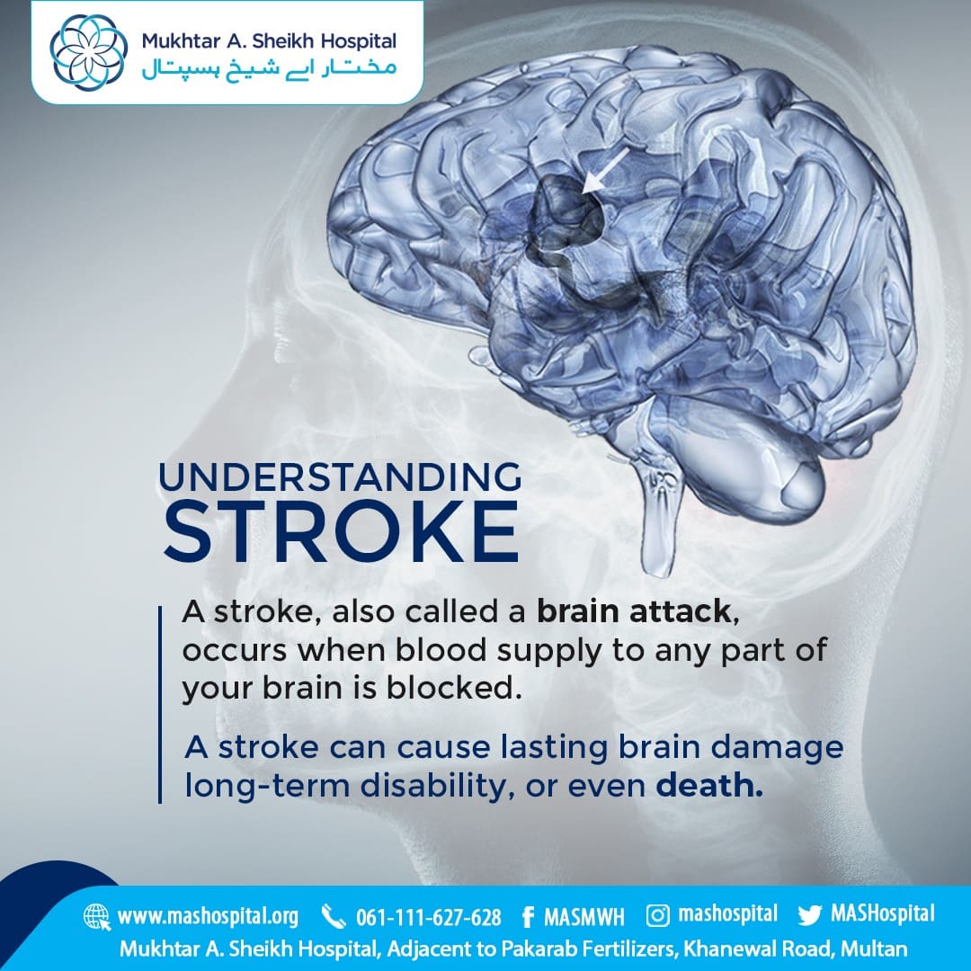 MASHospital's tweet photo. World Stroke Day is observed on Oct 29th to highlight the severity of a stroke attack. On this World Stroke Day, let's ensure the safety of our loved ones and uplift the survivors to improve their quality of life.
#MASMWH #MASHCares #SafeMASH #WorldStrokeDay #StrokeAwareness https://t.co/hpSmxzN3Av