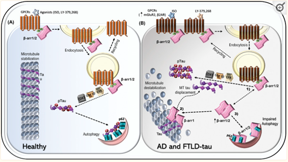 MultispanGPCR's tweet photo. β-arrestins are not only essential for #β2AR and mGluR2-mediated increase in pathogenic tau but also it has been shown that β-arrestin1 levels are increased in brains of Frontotemporal lobar degeneration (FTLD-tau) patients. #betaarrestin #Multispan #GPCR
https://t.co/3m2sWP7puC https://t.co/zx5OHU14YA