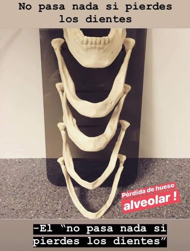 CDBethsaira's tweet image. o el clasico "Sáqueme todos los dientes de una vez" jajaja