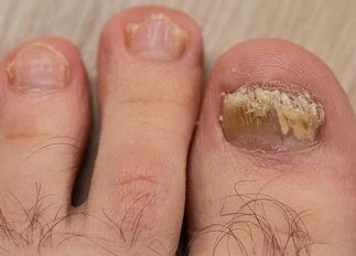 sprout_cookie's tweet photo. I love sucking wet crusty deceased toes and eating putrescent toe cheese 🧀👅👀 https://t.co/pJUR8hxAyC