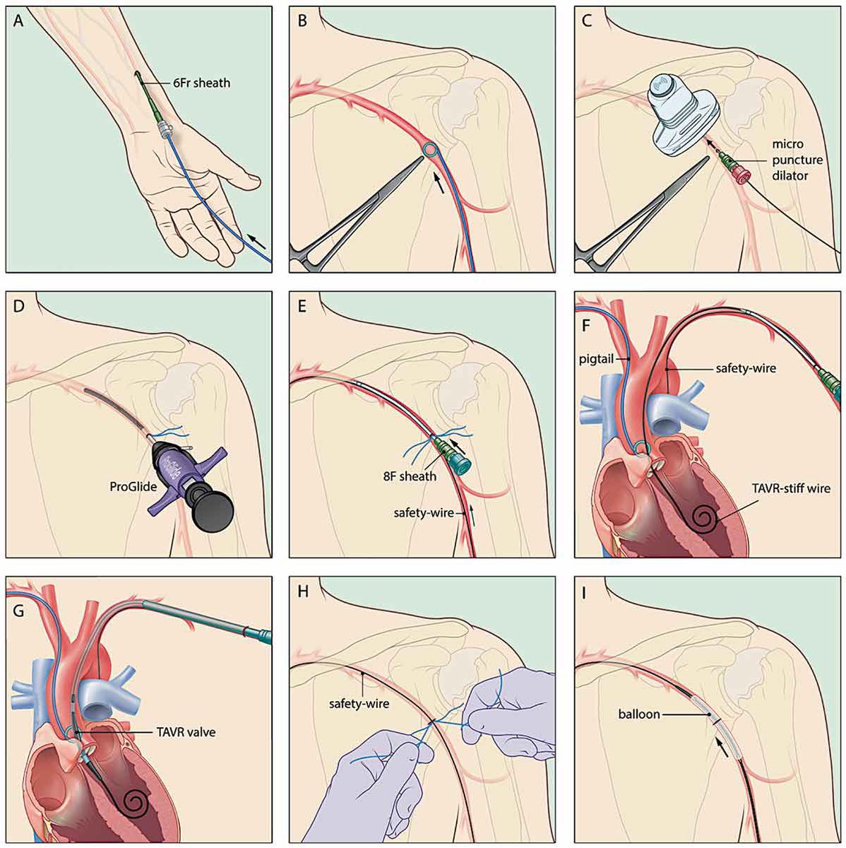 Evandro Martins F. MD tweet media