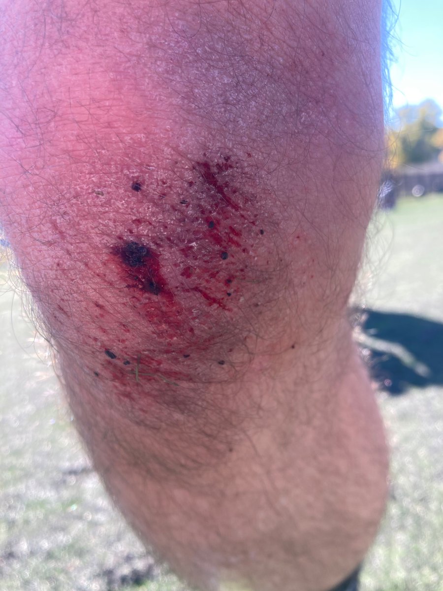 marshall_3rd's tweet photo. 2 tackle efforts = 1 astroturf knee burn = 1 DC attacker off his trajectory = 1 D1 and 1 D3 win. Today was a good day. https://t.co/azh7dPmRuo