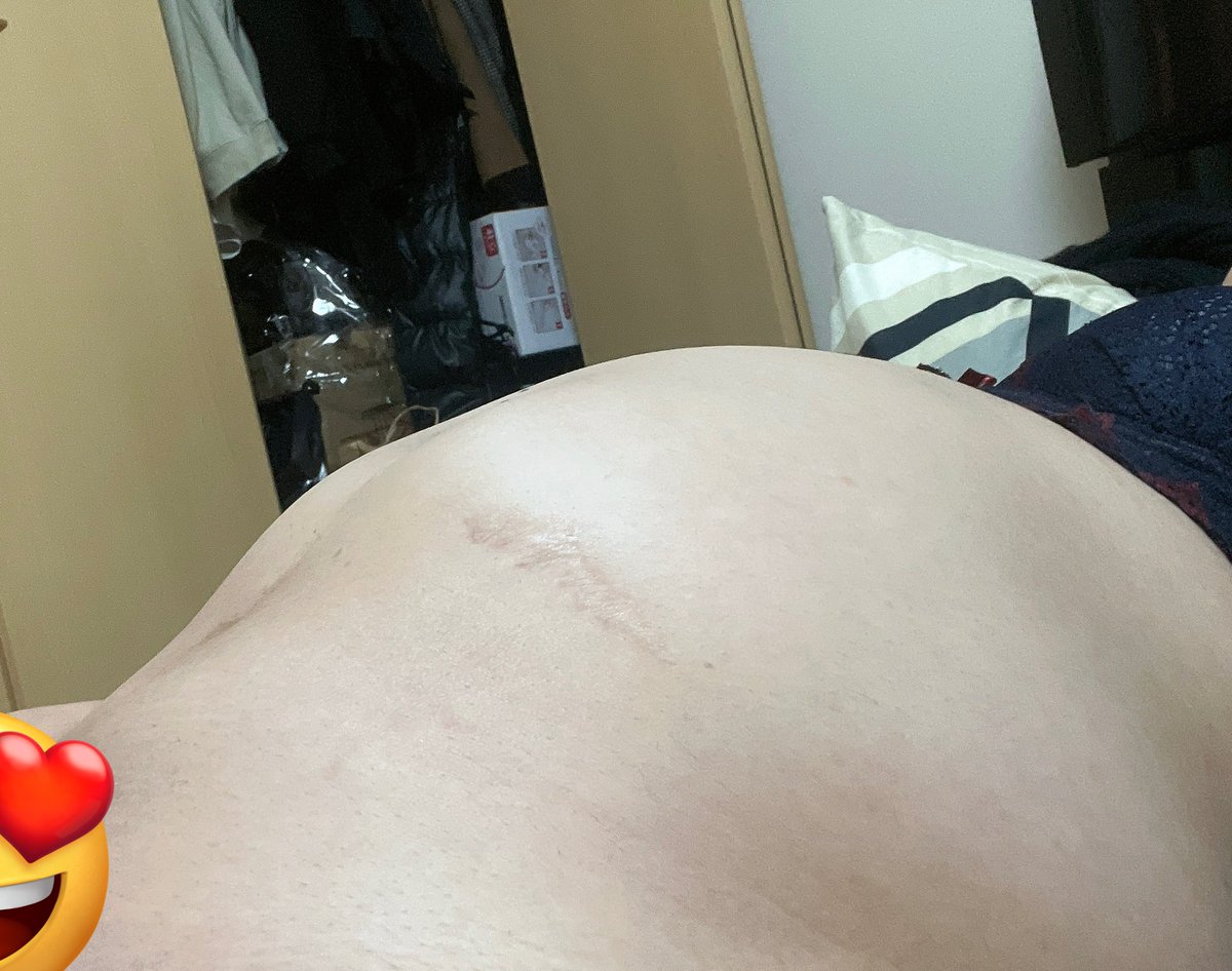 3L water enema