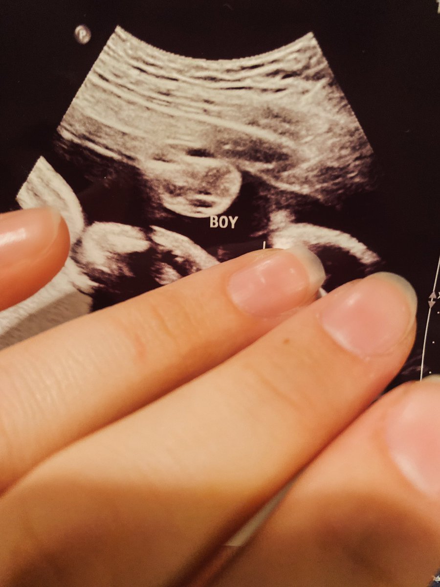 CaitieJ13's tweet photo. we have a son 💛 https://t.co/Tpnd9XvKmz