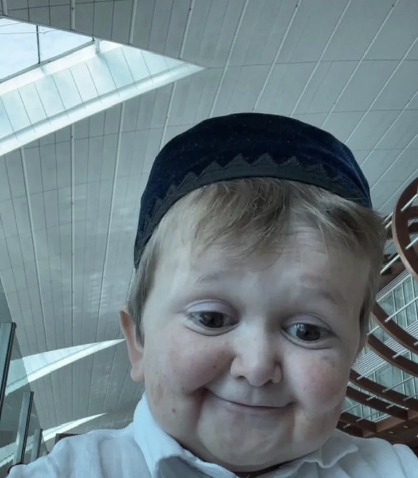 Hasbulla reactions on Twitter "SpeedUpdates1 Got the IG boys https