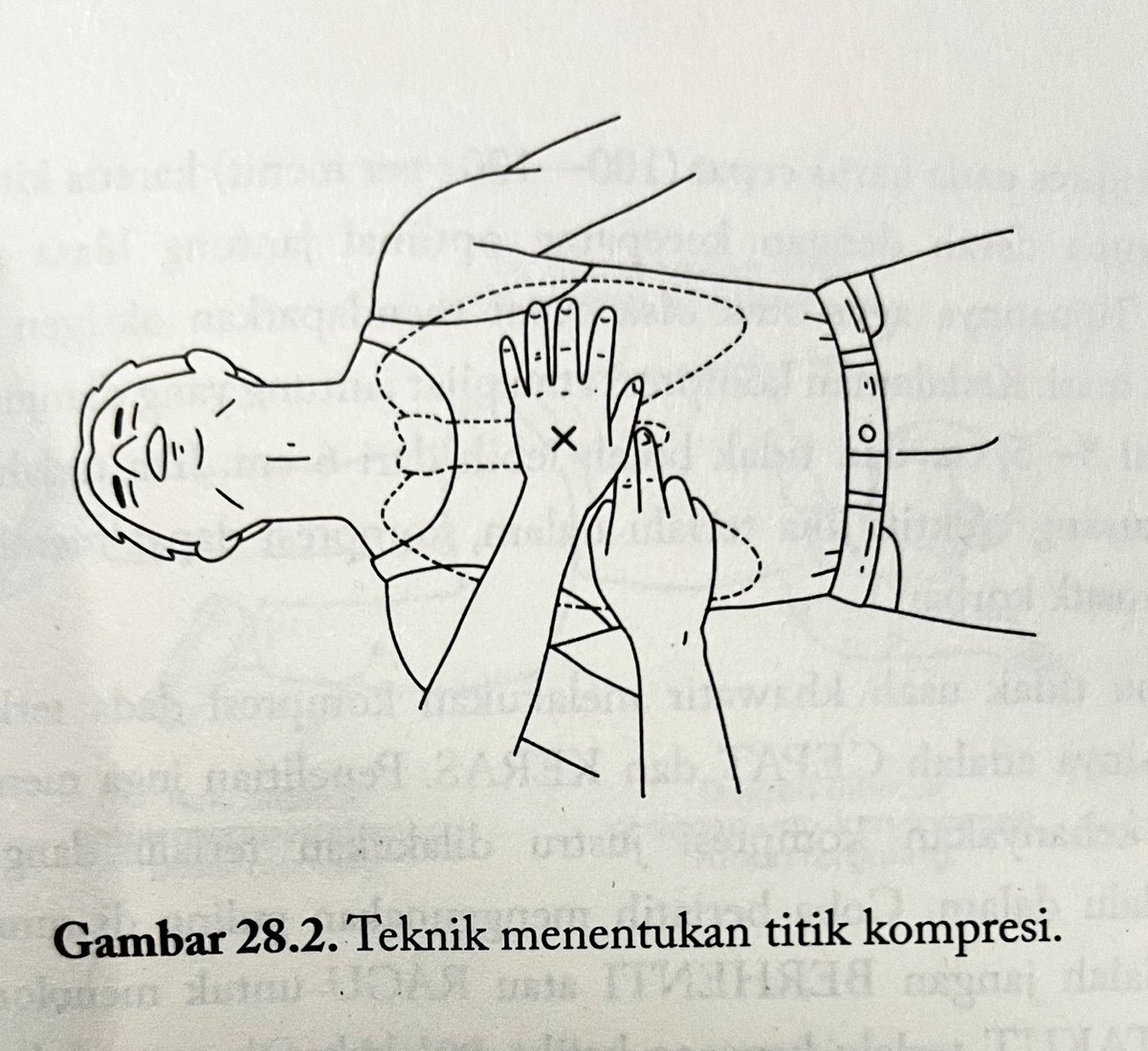 afrkml's tweet photo. Awam tidak terlatih SANGAT BOLEH DAN SANGAT BISA utk CPR ke orang henti jantung kak dg teknik CPR hands-only alias CPR tanpa memberikan bantuan napas.
Syaratnya ya minimal pernah baca/nonton video edukasi CPR meski belum ikut pelatihannya. Termasuk siapapun yg baca thread ini. https://t.co/XOAD3FG0g2
