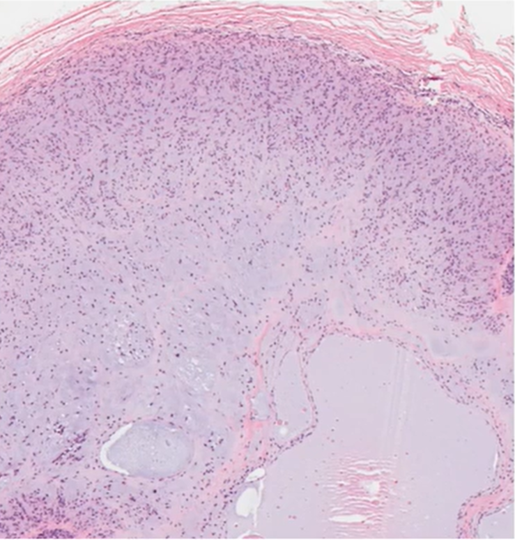 HENRYY_MD's tweet photo. #AFCMT #asdp22 continued https://t.co/IEuMD8WID3