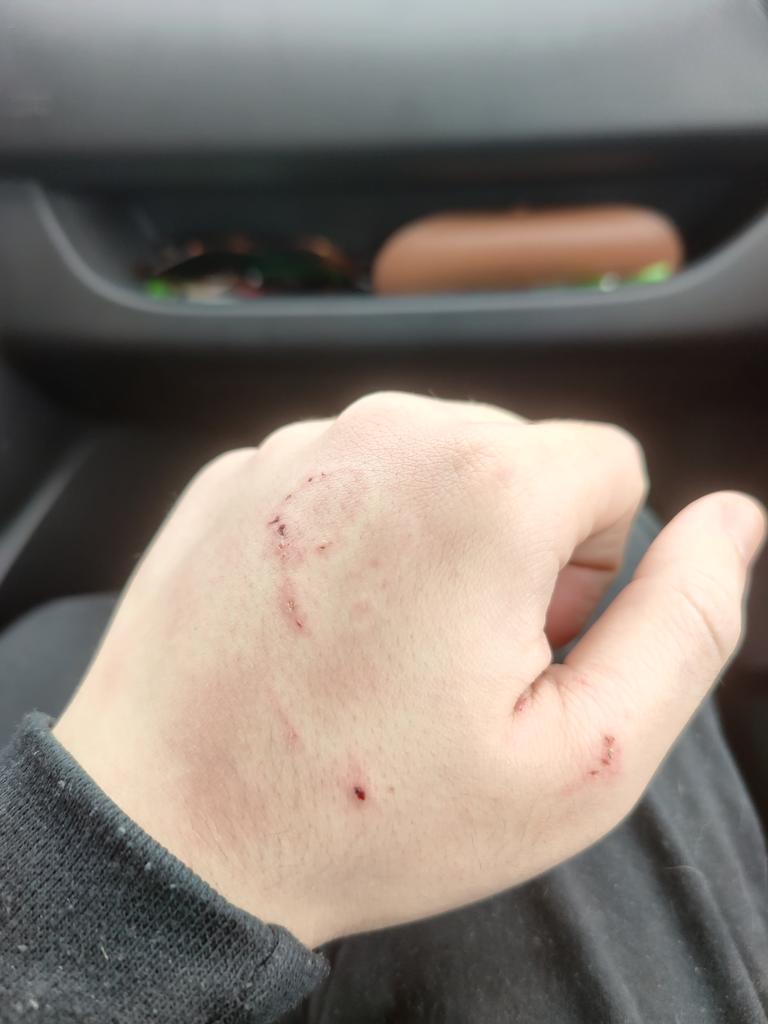 Bin in Österreich und <a href="/Apfelinchen_/">Sarah 🦕</a> hat mich gebissen :c