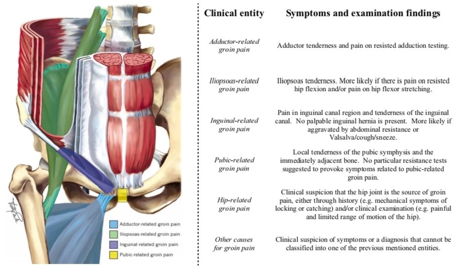 WillemHeijboer's tweet photo. 🚨 How reliable can we classify groin pain in athletes using the Doha agreement classification system? Find out in our new study (open access)!

Link: https://t.co/ceK9y5JzR9 https://t.co/aHpPXX7L1U
