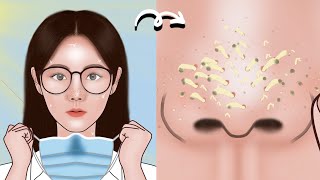dietrecipesd's tweet photo. Satisfying Full Blackhead Treatment At Home! ASMR skincare animation丨Meng&amp;#39;s Stop Motion https://t.co/rirZaOtO8y https://t.co/qE52XjjzrW