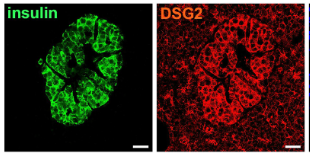 Claudine Bonder (@claudine_bonder) on Twitter photo Absolutely delighted to share our latest publication identifying desmoglein-2 as an important survival factor for pancreatic beta-islet cells. Many years and many contributors, <a href="/kay_mmin/">Kay Myo Min</a> <a href="/betacellgirl/">Claire Jessup</a> <a href="/toby81444960/">TheRealTobyCoates</a> et al
rdcu.be/cYzmd
Cell Death Disease <a href="/NaturePortfolio/">Nature Portfolio</a> Absolutely delighted to share our latest publication identifying desmoglein-2 as an important survival factor for pancreatic beta-islet cells. Many years and many contributors, <a href="/kay_mmin/">Kay Myo Min</a> <a href="/betacellgirl/">Claire Jessup</a> <a href="/toby81444960/">TheRealTobyCoates</a> et al
rdcu.be/cYzmd
Cell Death Disease <a href="/NaturePortfolio/">Nature Portfolio</a>