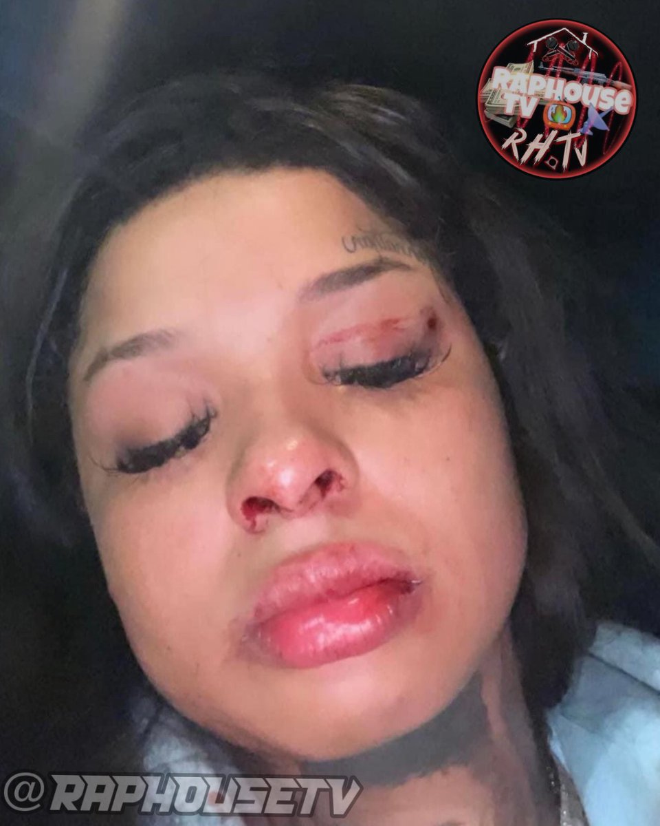 raphousetv2's tweet image. Chrisean Rock says that Blueface assaulted/beat her up after catching her texting another dude 💔🤦🏽‍♂️📲