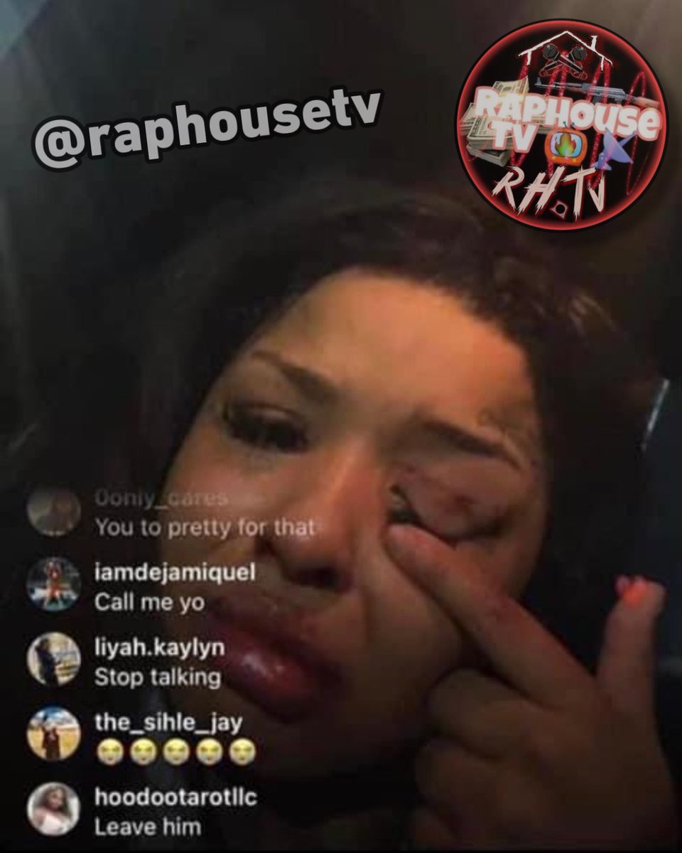 raphousetv2's tweet image. Chrisean Rock says that Blueface assaulted/beat her up after catching her texting another dude 💔🤦🏽‍♂️📲