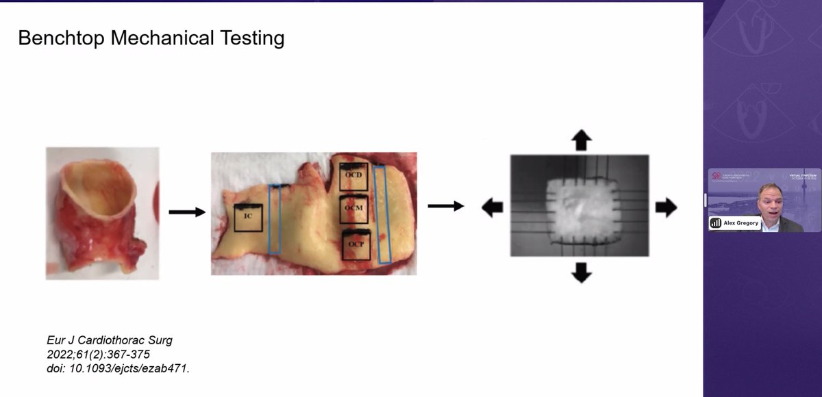 JMorenoGarijo's tweet photo. See Dr. Alex Gregory presenting "Not just a tube: The biomechanics of the aorta in the setting of aortic valve dysfunction" at the #TPES2022
@APIL_TGH @UofTanesthesia @EchofirstB @CASUpdate @CAS_CVT
https://t.co/uCbJfWnSce https://t.co/rnFLgir9oe