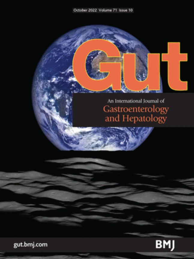 Gut Journal (@gut_bmj) on Twitter photo Listen to the important #GUTPodcast with <a href="/DLeddin/">Desmond Leddin</a> from <a href="/WorldGastroOrg/">World Gastroenterology Organisation (WGO)</a> on the paper "Climate change: a survey of global gastroenterology society leadership" via bit.ly/3T4Qvyq
Paper via bit.ly/3BEGORi
<a href="/BritSocGastro/">BSG</a> #ClimateChange #GreenEndo <a href="/FrontGastro_BMJ/">Frontline Gastro</a> Listen to the important #GUTPodcast with <a href="/DLeddin/">Desmond Leddin</a> from <a href="/WorldGastroOrg/">World Gastroenterology Organisation (WGO)</a> on the paper "Climate change: a survey of global gastroenterology society leadership" via bit.ly/3T4Qvyq
Paper via bit.ly/3BEGORi
<a href="/BritSocGastro/">BSG</a> #ClimateChange #GreenEndo <a href="/FrontGastro_BMJ/">Frontline Gastro</a>