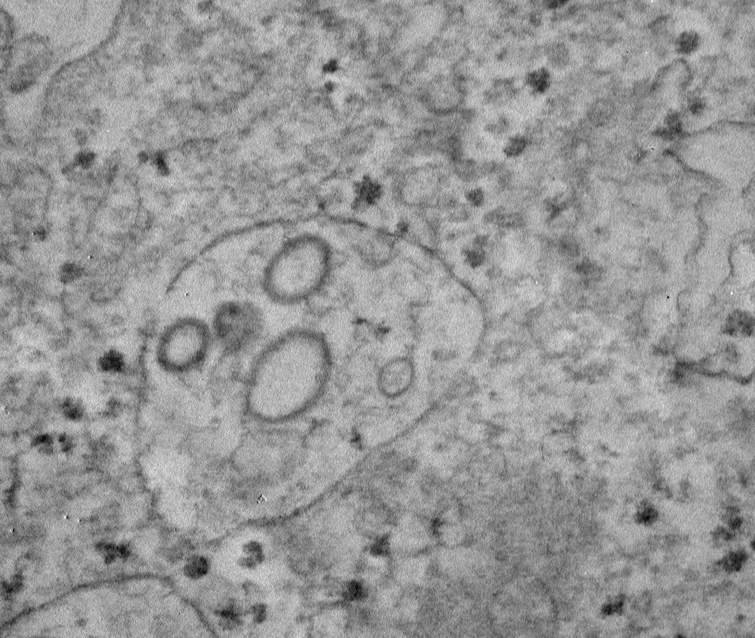 Keshav K Singh, PhD (@mitoscientist) on Twitter photo Happy Hallowen. There are mitochondria for every occasion.
#Halloween #Halloween2022
<a href="/Mito_at_GU/">Mito@GU</a> <a href="/Mito_News/">Mitochondria News</a> <a href="/Mito_Therapy/">Mitochondrial Medicine</a> <a href="/icmito/">Imperial College Mitochondria Network 🇵🇸</a> <a href="/IC_mitochondria/">IC Mitochondriacs</a> <a href="/mitojobs/">mitojobs</a> <a href="/MitoCanada/">MitoCanada</a> <a href="/UMDF/">United Mitochondrial Disease Foundation</a> <a href="/MitoResearch/">Mito Research</a> <a href="/mitowomen/">Women in Mitochondria</a> <a href="/CMitochondrie/">Club Mitochondrie</a>
<a href="/cure_mito/">CureMITO</a> <a href="/sciam/">Scientific American</a> <a href="/MitOtalks/">MITOtalks</a> @sciencenews <a href="/newscientist/">New Scientist</a> Happy Hallowen. There are mitochondria for every occasion.
#Halloween #Halloween2022
<a href="/Mito_at_GU/">Mito@GU</a> <a href="/Mito_News/">Mitochondria News</a> <a href="/Mito_Therapy/">Mitochondrial Medicine</a> <a href="/icmito/">Imperial College Mitochondria Network 🇵🇸</a> <a href="/IC_mitochondria/">IC Mitochondriacs</a> <a href="/mitojobs/">mitojobs</a> <a href="/MitoCanada/">MitoCanada</a> <a href="/UMDF/">United Mitochondrial Disease Foundation</a> <a href="/MitoResearch/">Mito Research</a> <a href="/mitowomen/">Women in Mitochondria</a> <a href="/CMitochondrie/">Club Mitochondrie</a>
<a href="/cure_mito/">CureMITO</a> <a href="/sciam/">Scientific American</a> <a href="/MitOtalks/">MITOtalks</a> @sciencenews <a href="/newscientist/">New Scientist</a>