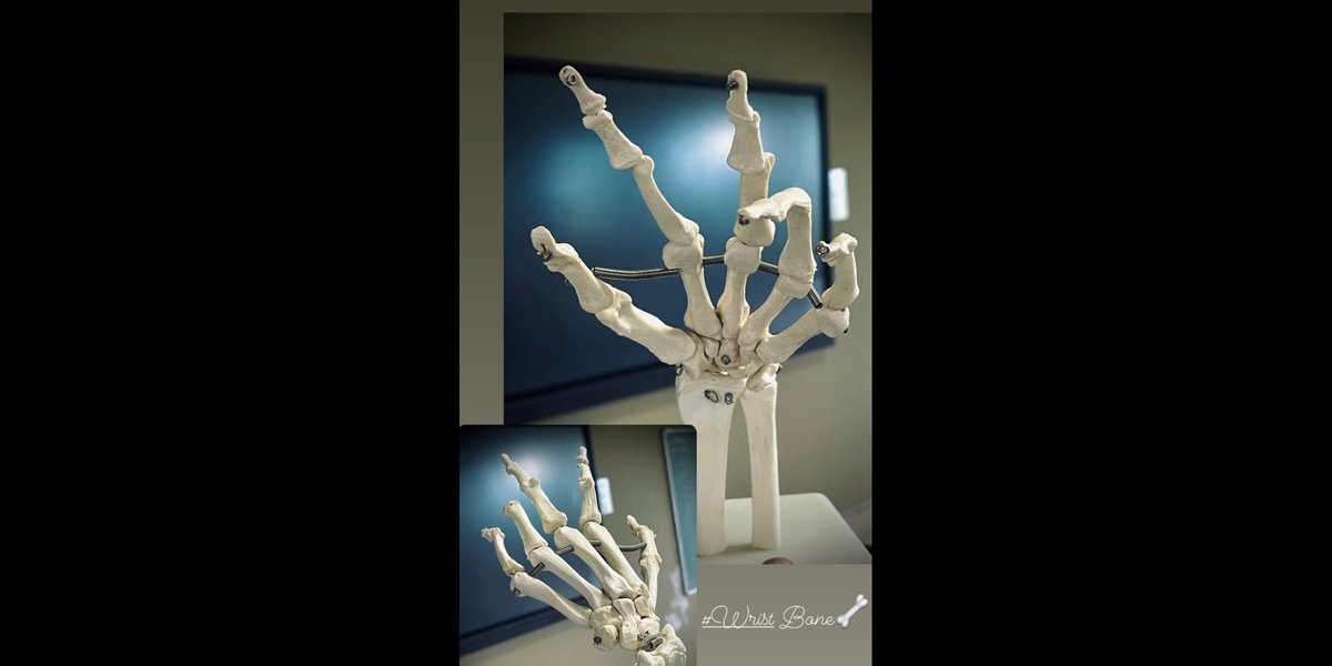 MoAyus's tweet photo. Wrist joint https://t.co/yjzYUtjmJe