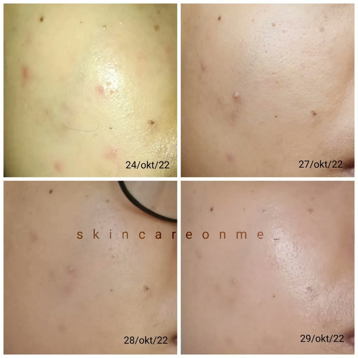 skincareonme_'s tweet photo. Perbaiki Skin Barrier dengan Ceramide.

Akhir-akhir ini lagi hits banget kan Moisturizer dengan kandungan Ceramide.

Nah pas bgt Adleeva baru aja launching Basic Moisturizer dengan kandungan Ceramide juga lhoo. Yuk simak! ❤️ https://t.co/8siNnIdyyZ