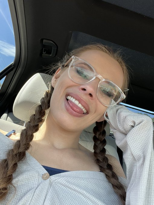 I tell &lsquo;em &ldquo;make me a grill&rdquo; then they did   So happy to look and feel like myself again but not done