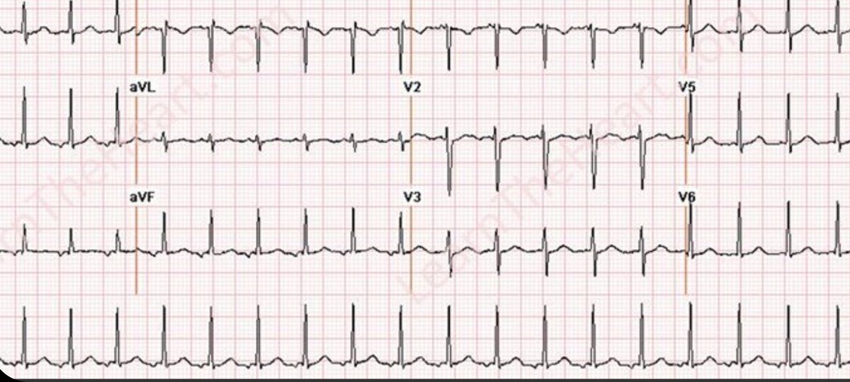 Electrophysiology tweet media