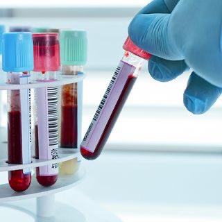 ATM___1's tweet image. Order of Draw 🩸💉
#Medical Laboratory
#phlebotomy