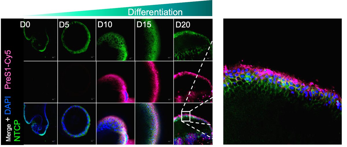 Great work from <a href="/Chuan_Lim_VPRL/">Chuan Lim</a> and <a href="/BeardLabUofA/">Michael Beard</a>  + others.  Human Liver Organoids as a Patient-derived Model for HBV Infection and Cellular Response.  <a href="/UofA_SET/">Faculty of Sciences, Engineering and Technology</a> <a href="/AusHepVirol/">Australian Centre For Hepatitis Virology</a> <a href="/UniofAdelaide/">Uni of Adelaide</a>   biorxiv.org/content/10.110…