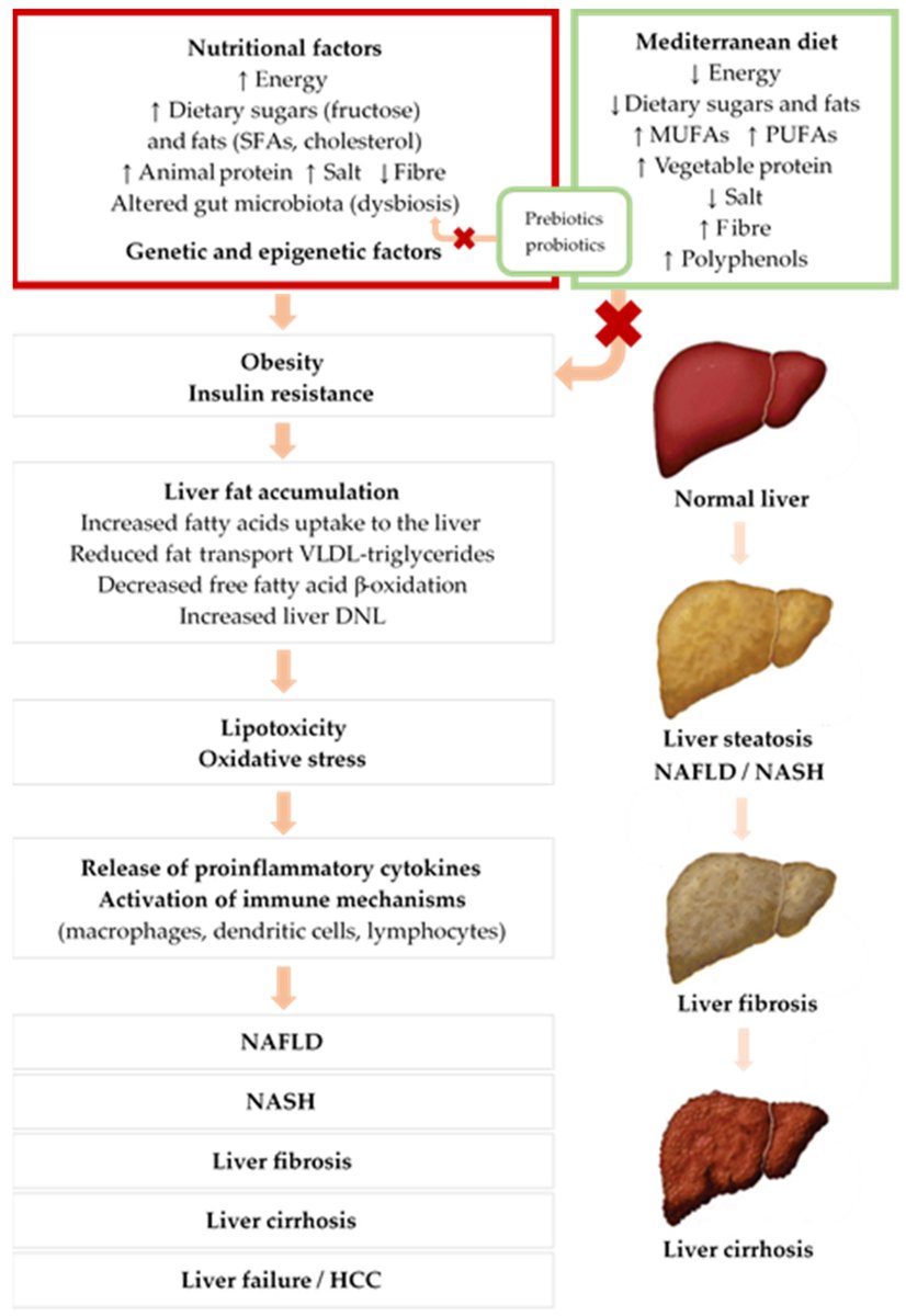 #mdpinutrients 
📚Recommend the Editor’s Choice article "Overview of Non-Alcoholic #Fatty #Liver #Disease (#NAFLD) and the Role of #Sugary #Food #Consumption and Other #Dietary #Components in Its Development" by Dr. Emilio Sacanella Meseguer et al. 

👉mdpi.com/2072-6643/13/5…
