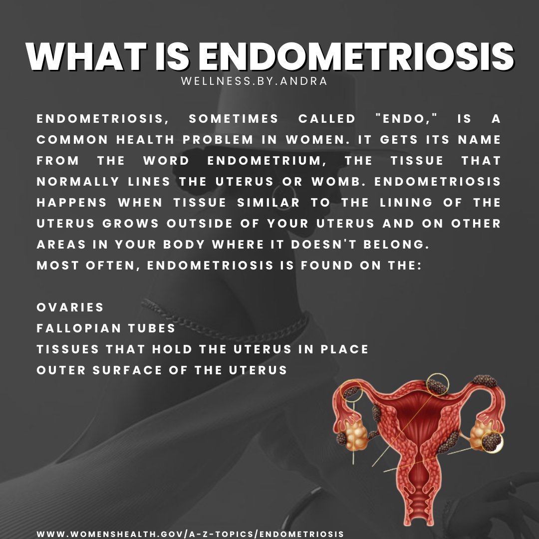 Endometriosis We have yet to understand the root cause in scientific