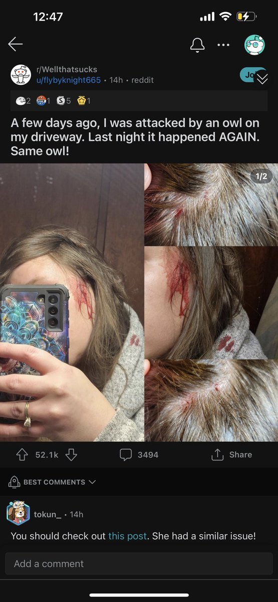 badwolftn's tweet photo. Every time I tell the story about how an owl tried to attack me once and then stalked me all summer, people think I’m nuts (to be fair, I thought I was going nuts too). Just saw this on Reddit and turns out Barred Owls are territorial and aggressive so I’m feeling validated haha https://t.co/2Q2Nh4Dlvu