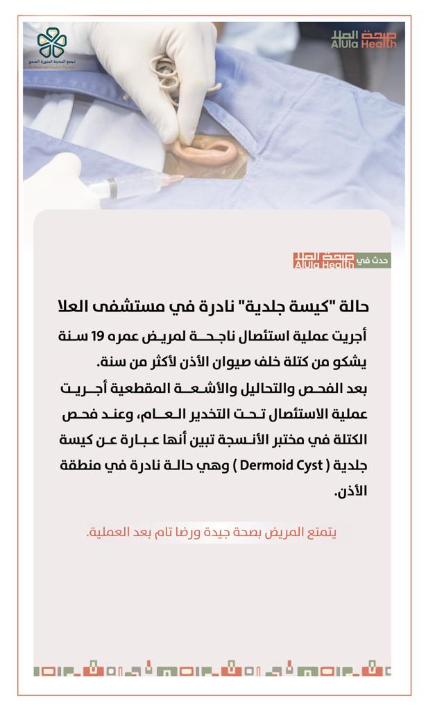 AlUla_Health's tweet photo. استئصال كيسه جلدية نادرة خلف  صيوان الأذن لمريض بمستشفى الأمير عبدالمحسن بمحافظة #العلا
#صحة_العلا https://t.co/Vy6kjoVDZG