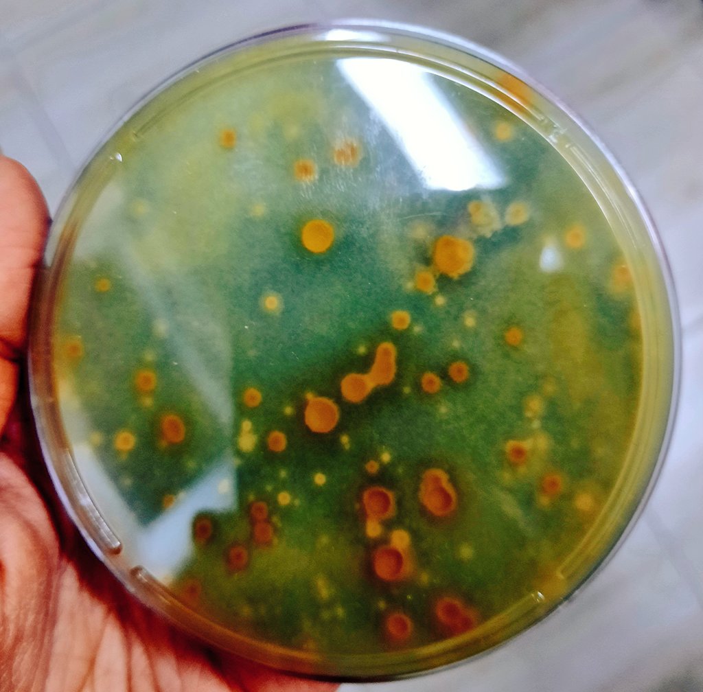 cennetelmasi's tweet photo. Fungus crater...
Uninvited guest Penicillium.
#phytopathology #fungus #labdiaries #trichoderma #penicillium #plantpathology #messagetotheuniverse https://t.co/XnuQcdU3K1