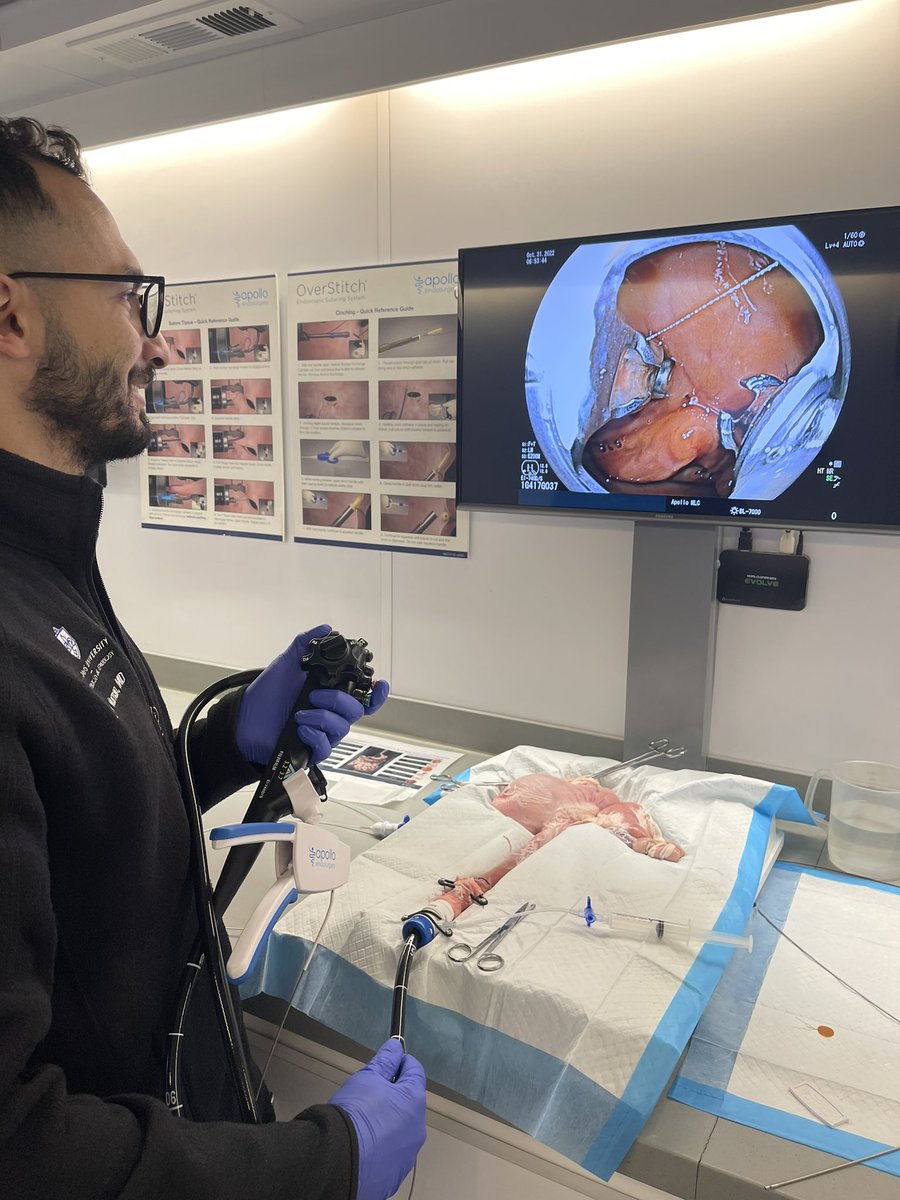 NumanLaith's tweet photo. What a great start to the week with endoscopic #suturing using #OverStitch and #XTack by @APOLLO_ENDO. #GITwitter #AdvancedEndoscopy #MedEd #MedTwitter https://t.co/o2WHKIql6w