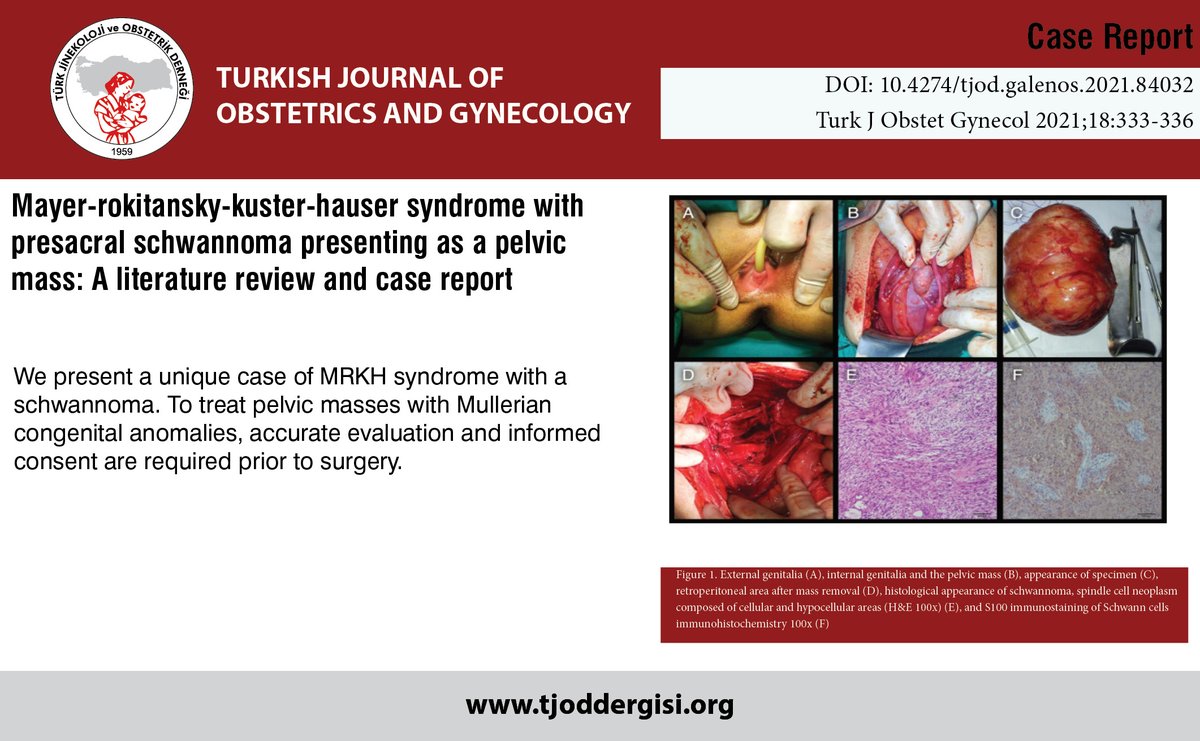 TJODOfficial's tweet photo. Mayer-rokitansky-kuster-hauser syndrome with presacral schwannoma presenting as a pelvic mass: A literature review and case report

You can see the free full text of the research by Raziye Narin et al.

Link : https://t.co/Cv1vEzyycO

#MRKH #syndrome #schwannoma #pelvicmass https://t.co/Z5KcMVlL31