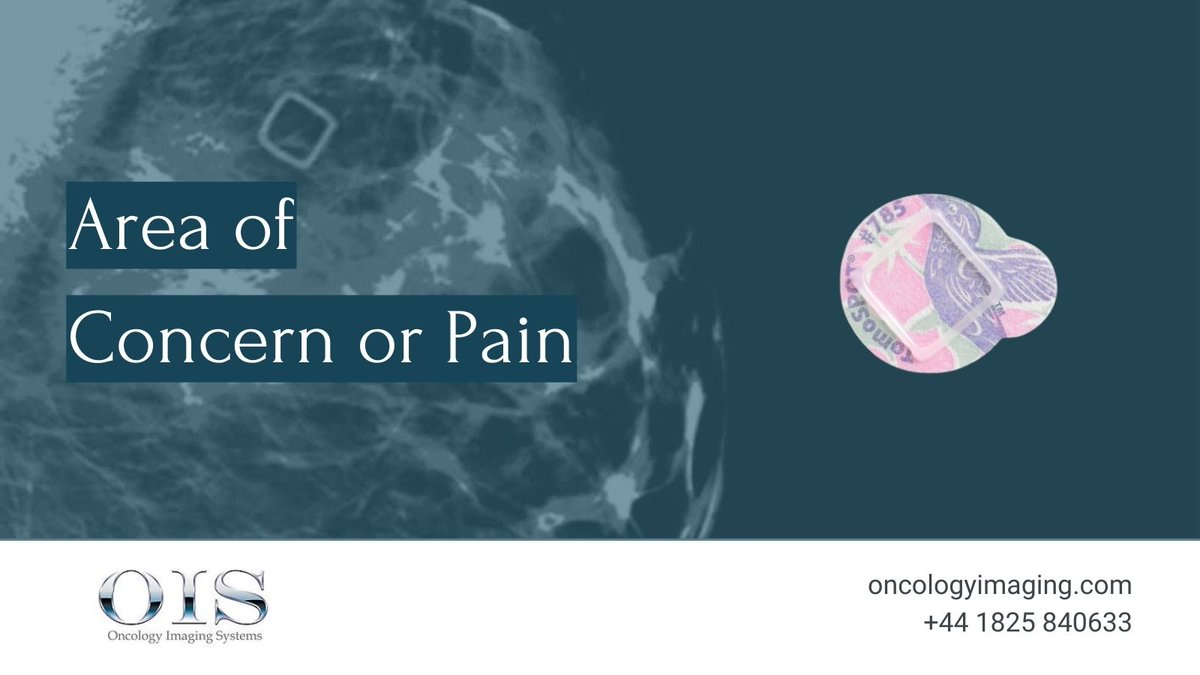 To round up our feature on The Beekley Skin Marking System for Mammography, we're going to talk about areas of concern or focal pain that are not physically manifested.

Why use a square to mark non-palpable areas of concern or focal pain?
Find out here: bit.ly/3dke6vV