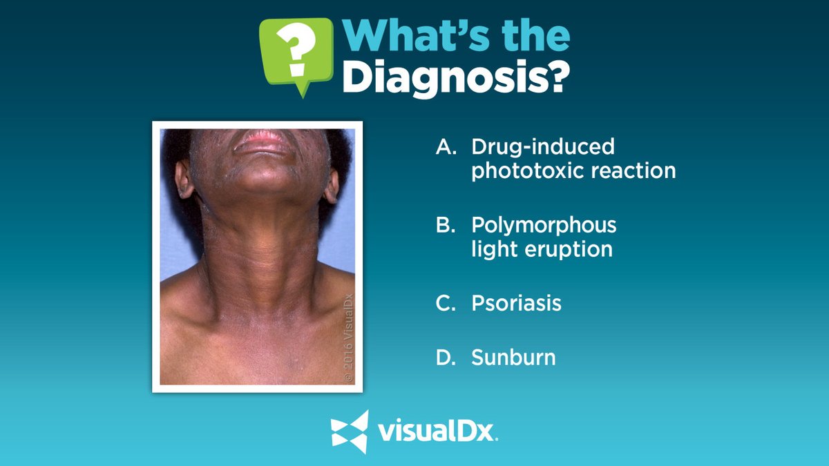 What's the Dx? 58 yo man w/painful rash that developed over his neck &amp; chest after landscaping during sun-intense hours earlier that day. Violaceous, fine, scaly plaques in a photodistributed fashion were visible over the neck &amp; chest. He was on SMZ-TMP. Tell us your Dx!
