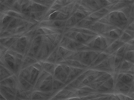 Electrospun Construct Mimics Elasticity of Blood Vessels

Researchers at the University of Sydney in Australia have developed an electrospun blood vessel replacement. The material contains tropoelastin, a natural precursor for elastin, a key compone…
medgadget.com/?p=1540691&utm…
