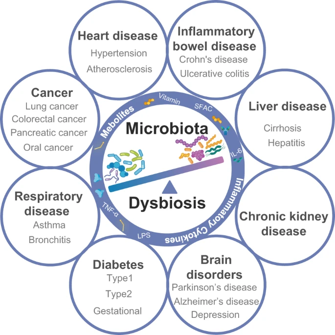 IberianCitizen's tweet photo. La microbiota puede afectar a casi todos los aspectos del huésped, mientras que su disbiosis está relacionada con un amplio espectro de enfermedades
https://t.co/erJigsp714 https://t.co/k5NlDnWZrV