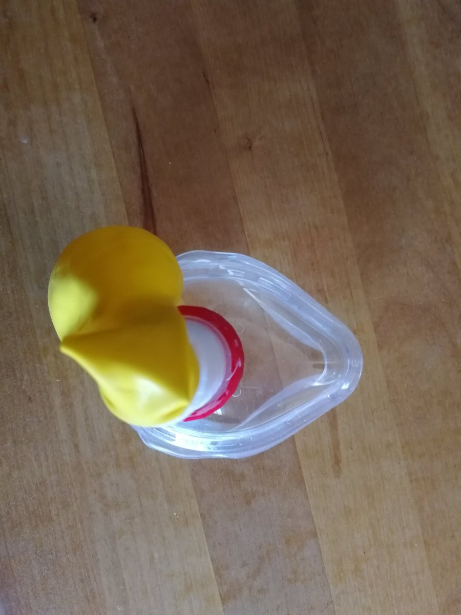 PAUSAFE2's tweet photo. A 3d printed mask to treat glue ear disease. For a 5 years old kid. Working great! 
#otovent #otitis #kids #glueear #3d https://t.co/26RlIGEYbV