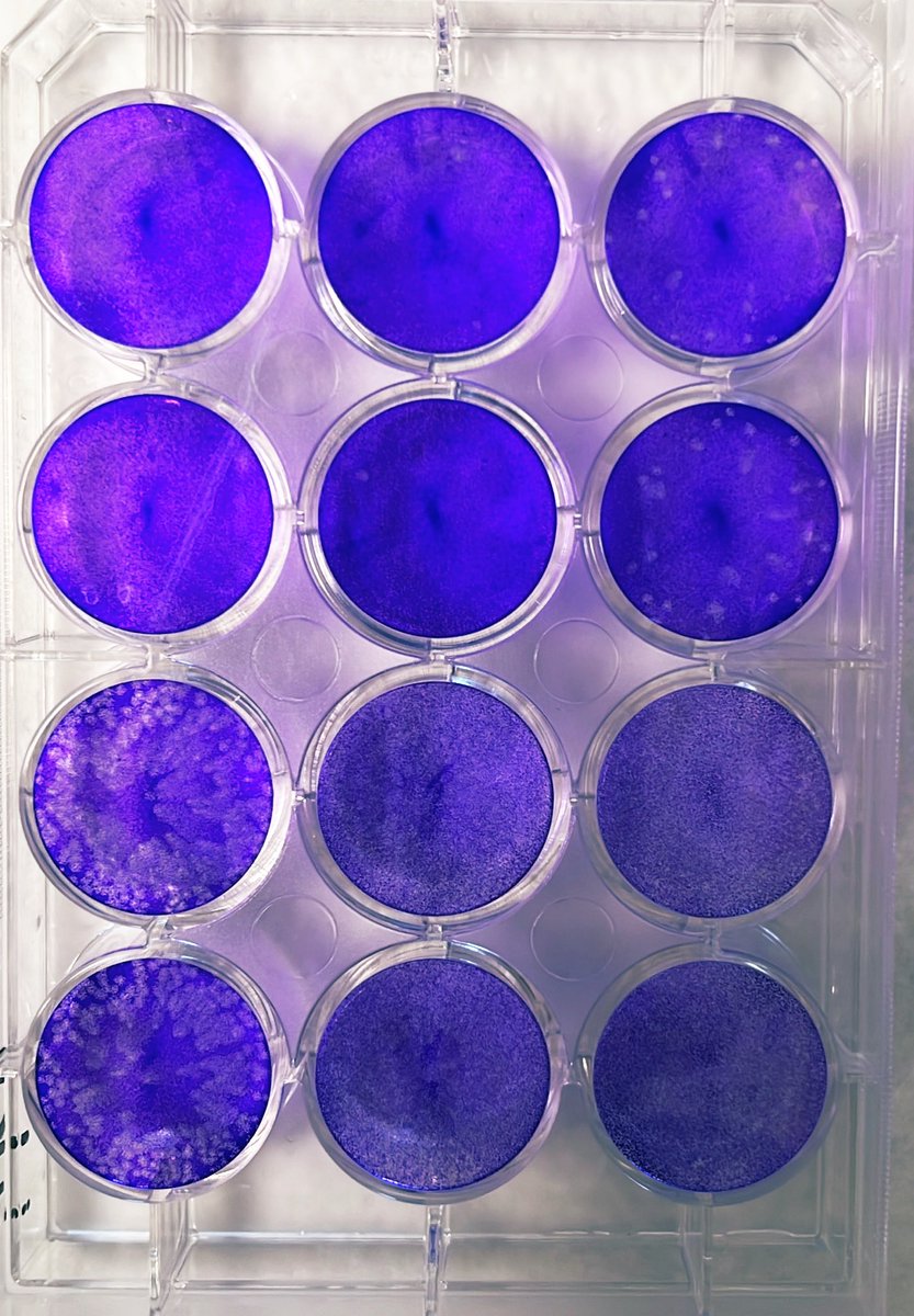 Such a (happy) memory recall during my phd student life working on the lovely mosquito-borne viruses, DENV, CHIKV. #SARSCoV2 🦠