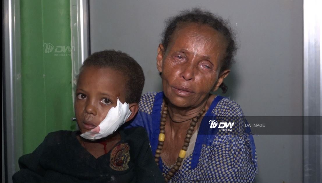 zufanMZ21's tweet photo. Children of Tigray are terrified of drone attacks daily.🩸
#SupportHR6600 #Support3199
@SFRCdems @SenateForeign @SenatorMenendez @BradSherman @JakeSullivan46 @WhiteHouse @antonioguterres @SecBlinken https://t.co/cb27Ztrv0u