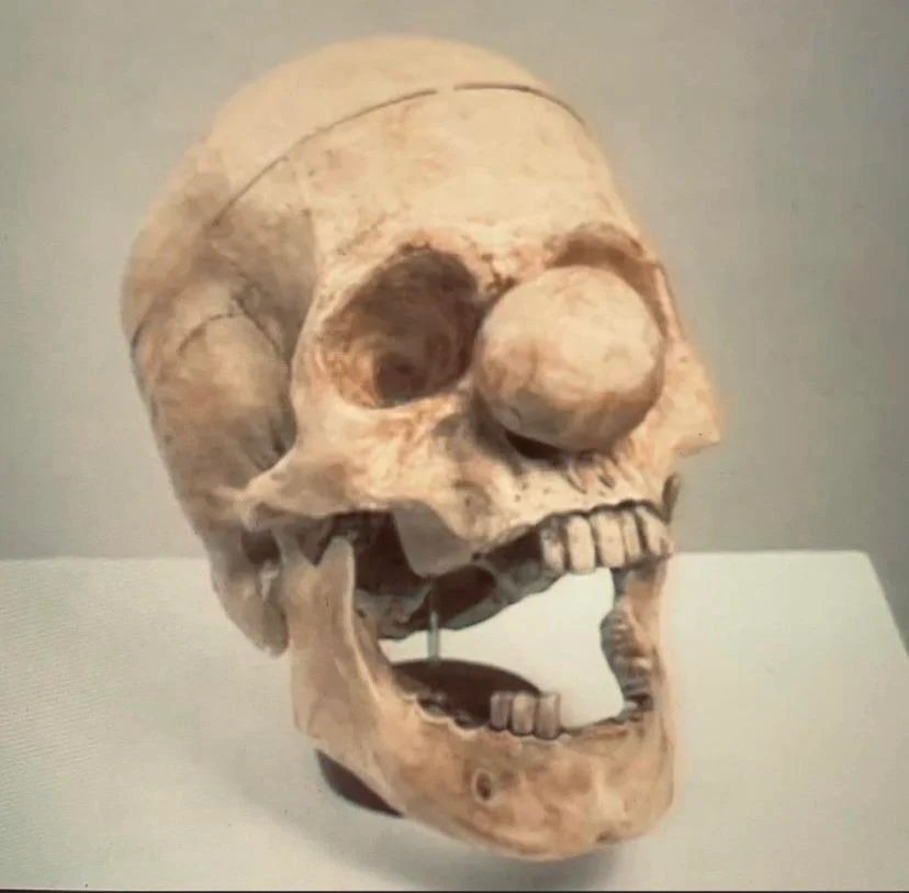 The skull of someone who bought btc at 69k and sold at 21k