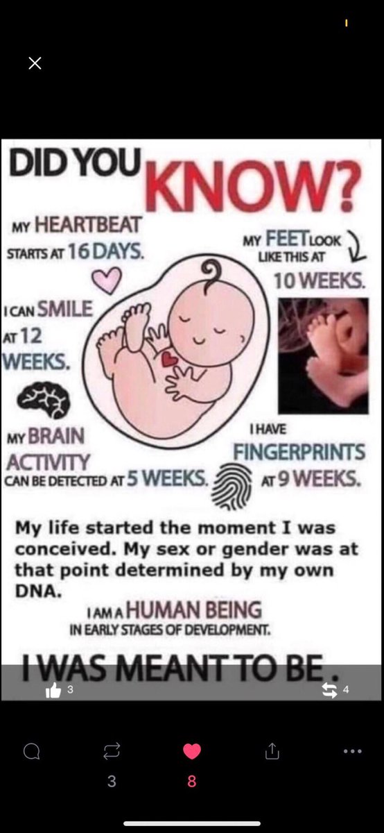 GodsTask's tweet image. Abortion is murder!