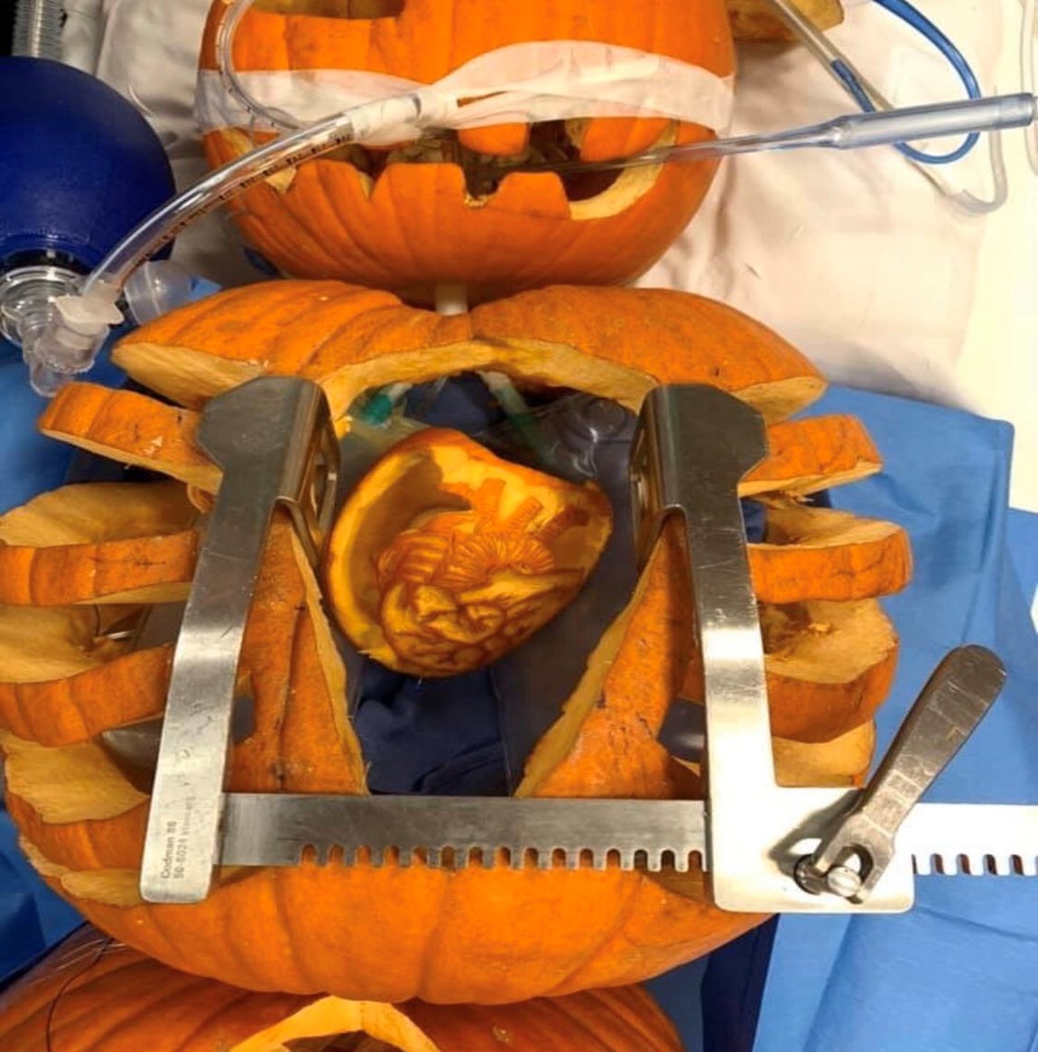 Happy Halloween!  Ready to cannulate for CPB (Cardio Pumpkin Bypass)